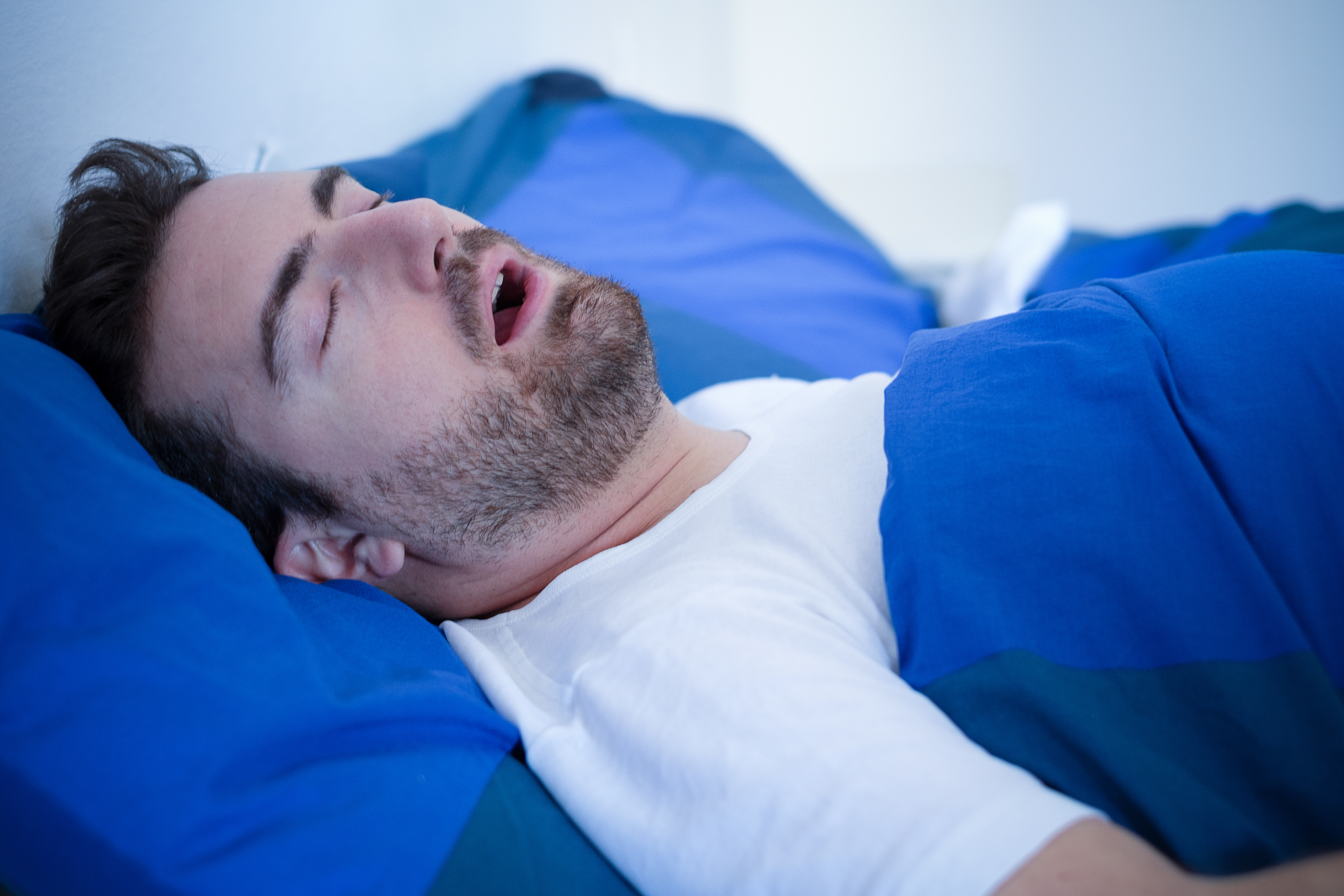 ¿En qué se relacionan la apnea del sueño y el sobrepeso?